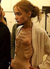 Skinny Girls photo 1 of 5