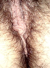 Amazing Hairy Girls photo 8 of 9